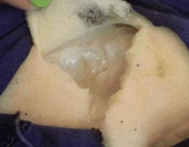 私密出发痒,揭秘原因及应对策略